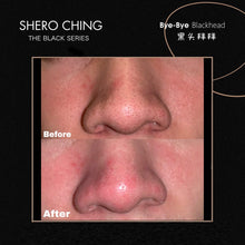 Shero Ching Bye Bye Blackhead Set
